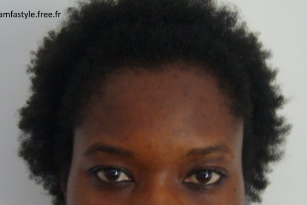 Tâches du visage